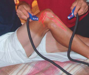 Low-Level Laser Therapy The Cold Laser: The Most Versatile Healthcare Tool of the 21st Century