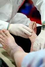 Diabetic Foot Requires Special Care