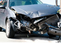 Motor Vehicle Accidents: The Most Common Cause of Traumatic Vertebrobasilar Ischemia