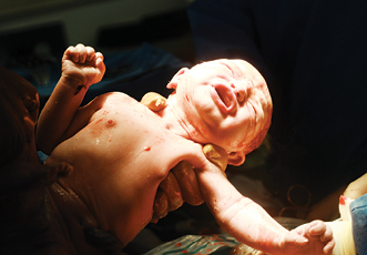The Implications for Birth Injury and the Development of Spinal Deformity