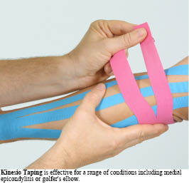 The History and Mystery of the Kinesio Taping® Method