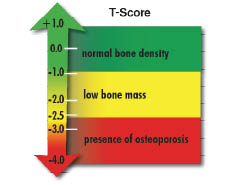 The Importance of Bone Health, Structure and Function